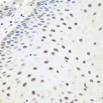 EXO1 Polyclonal Antibody