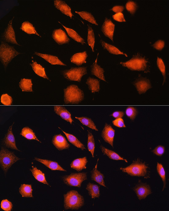 EXT2 Polyclonal Antibody