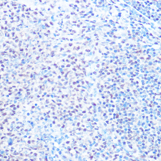 SNRPB Polyclonal Antibody