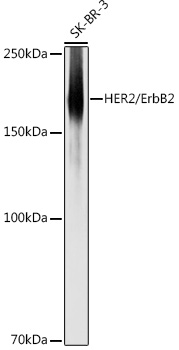 HER2 / ErbB2 Polyclonal Antibody