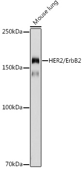 HER2 / ErbB2 Polyclonal Antibody