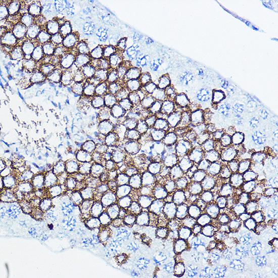 HER2 / ErbB2 Polyclonal Antibody