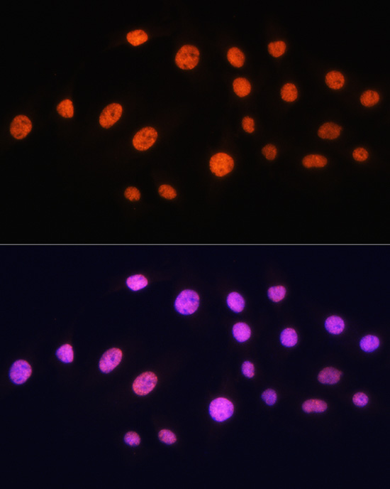 KAT2A Polyclonal Antibody