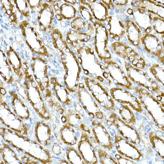 RHOT2 Polyclonal Antibody