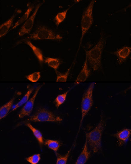 CKMT1B Polyclonal Antibody