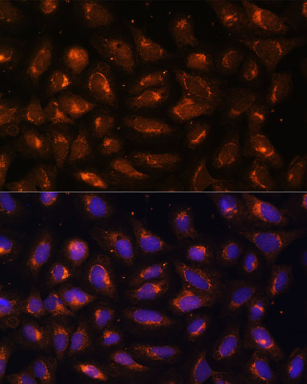 CKMT1B Polyclonal Antibody