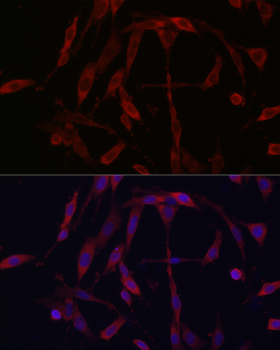 KIF5A Polyclonal Antibody
