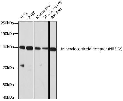 NR3C2 Polyclonal Antibody