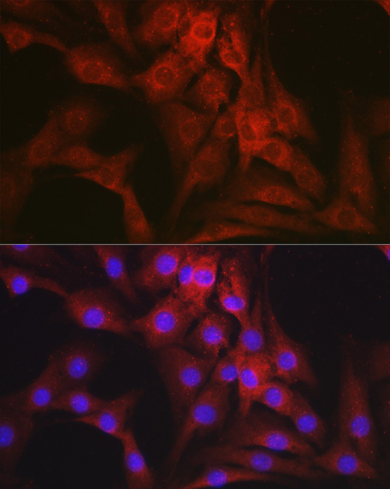 NR3C2 Polyclonal Antibody