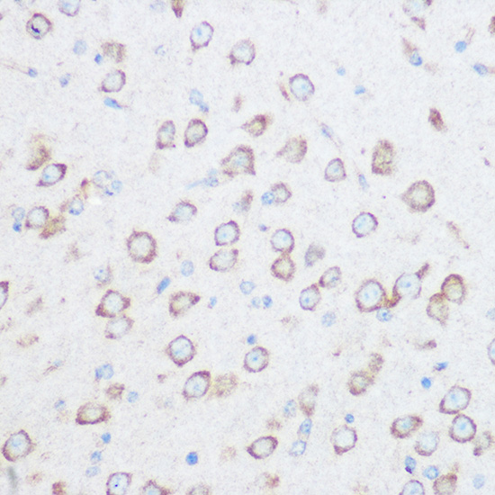CSPG4 Polyclonal Antibody