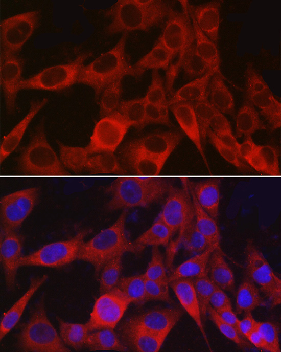 CSPG4 Polyclonal Antibody