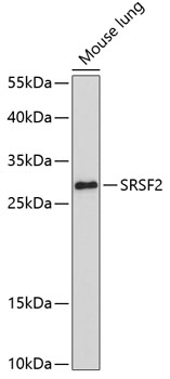 SRSF2 Polyclonal Antibody