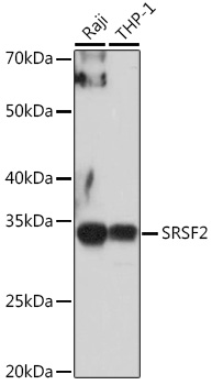 SRSF2 Polyclonal Antibody