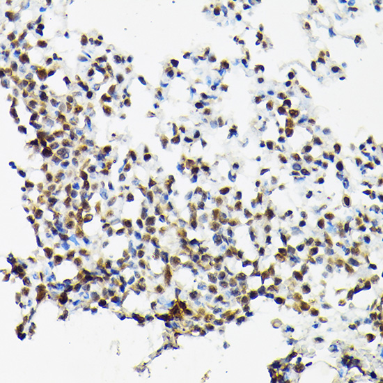 SRSF2 Polyclonal Antibody