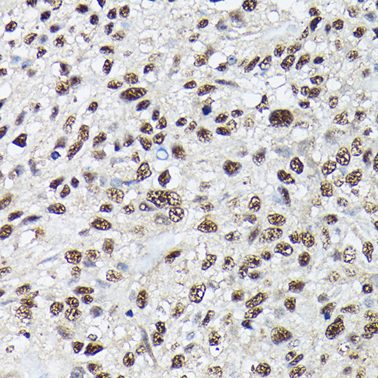 SRSF2 Polyclonal Antibody