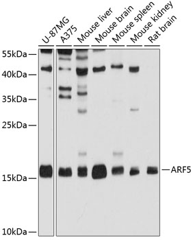 ARF5 Polyclonal Antibody