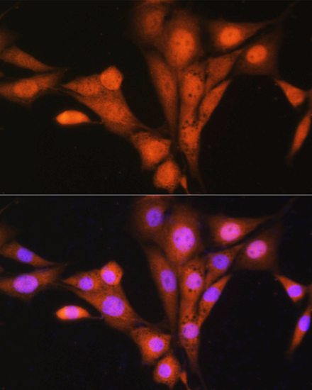 ASNA1 Polyclonal Antibody