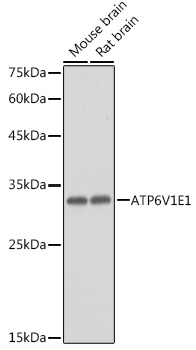 ATP6V1E1 Polyclonal Antibody