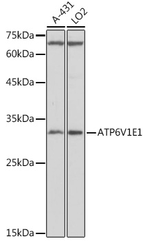ATP6V1E1 Polyclonal Antibody