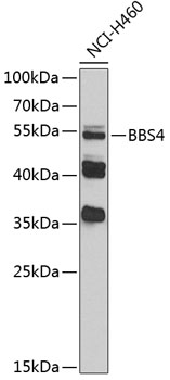 BBS4 Polyclonal Antibody