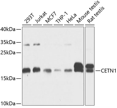 CETN1 Polyclonal Antibody