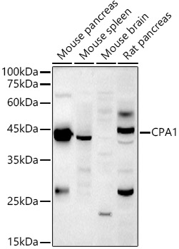CPA1 Polyclonal Antibody
