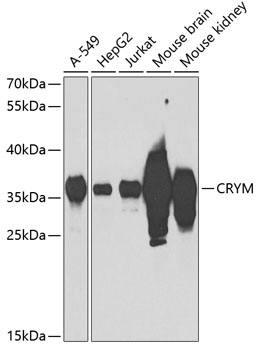CRYM Polyclonal Antibody