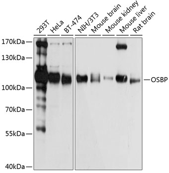 OSBP Polyclonal Antibody