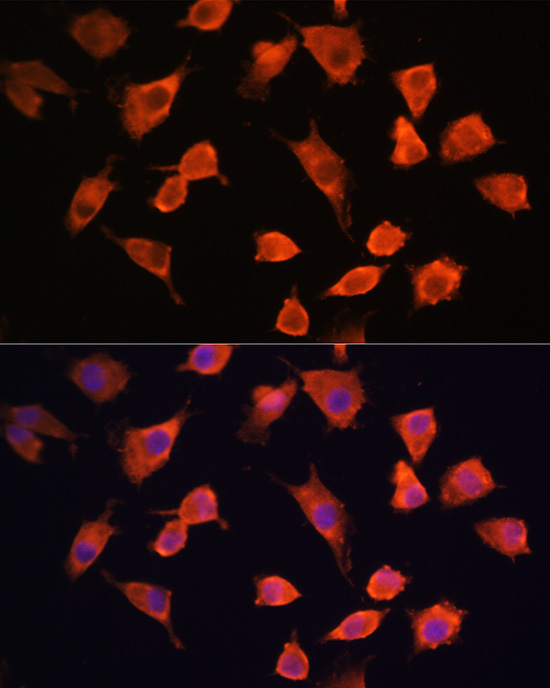 PFDN5 Polyclonal Antibody