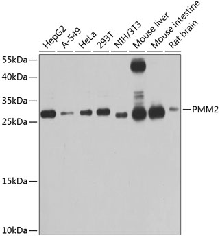PMM2 Polyclonal Antibody