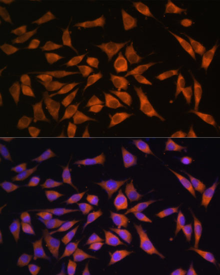 PMM2 Polyclonal Antibody