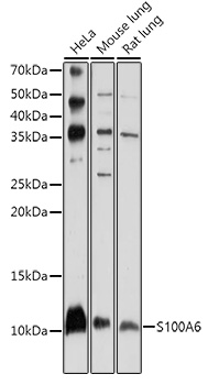 S100A6 Polyclonal Antibody