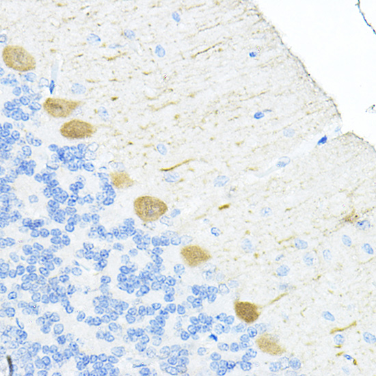 S100A6 Polyclonal Antibody