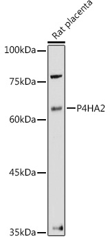 P4HA2 Polyclonal Antibody