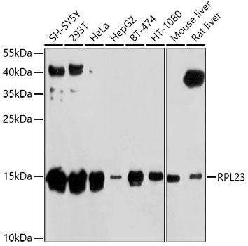 RPL23 Polyclonal Antibody