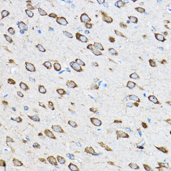 RPL23 Polyclonal Antibody