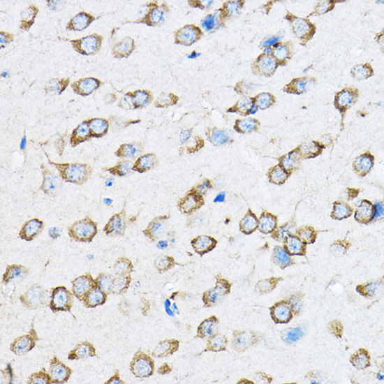 RPL23 Polyclonal Antibody