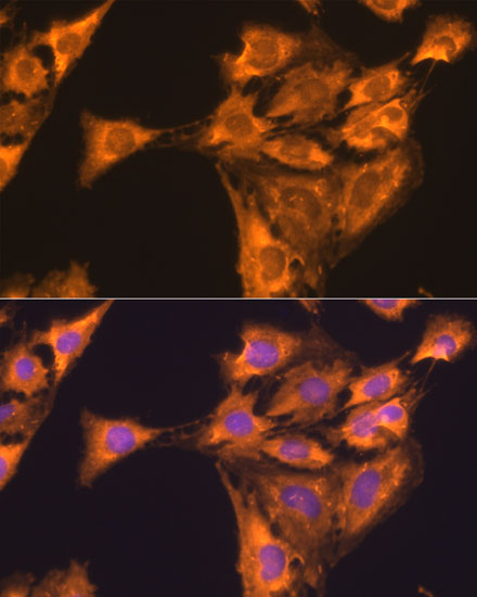 RPL23 Polyclonal Antibody