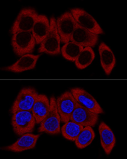 RPL23 Polyclonal Antibody