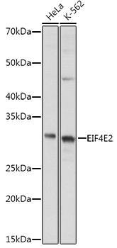 EIF4E2 Polyclonal Antibody