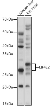 EIF4E2 Polyclonal Antibody