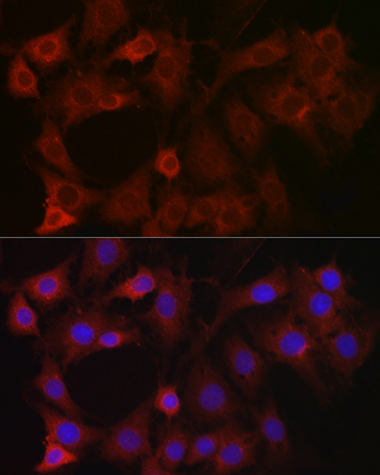 EIF4E2 Polyclonal Antibody
