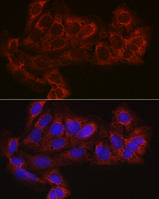 EIF4E2 Polyclonal Antibody