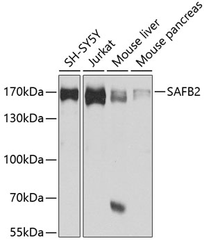 SAFB2 Polyclonal Antibody