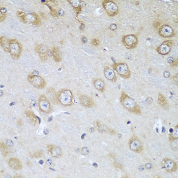TMOD3 Polyclonal Antibody