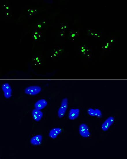 NOP58 Polyclonal Antibody