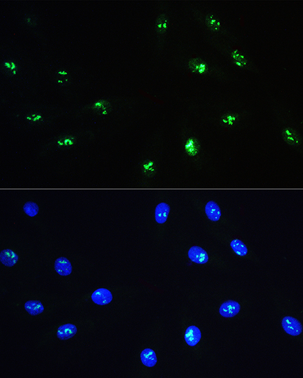 NOP58 Polyclonal Antibody