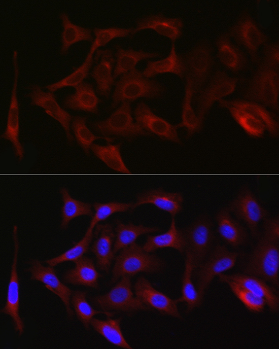 PRKCZ Polyclonal Antibody
