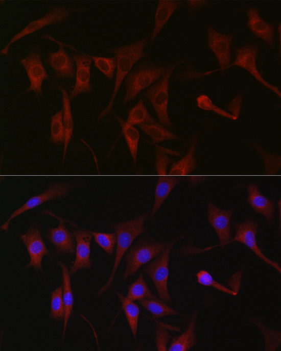 PRKCZ Polyclonal Antibody