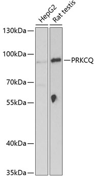 PRKCQ Polyclonal Antibody